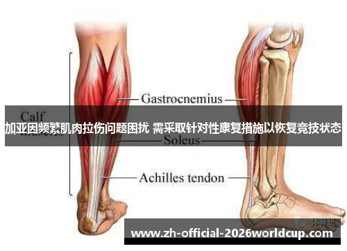 加亚因频繁肌肉拉伤问题困扰 需采取针对性康复措施以恢复竞技状态 加亚因频繁肌肉拉伤问题困扰 需采取针对性康复措施以恢复竞技状态